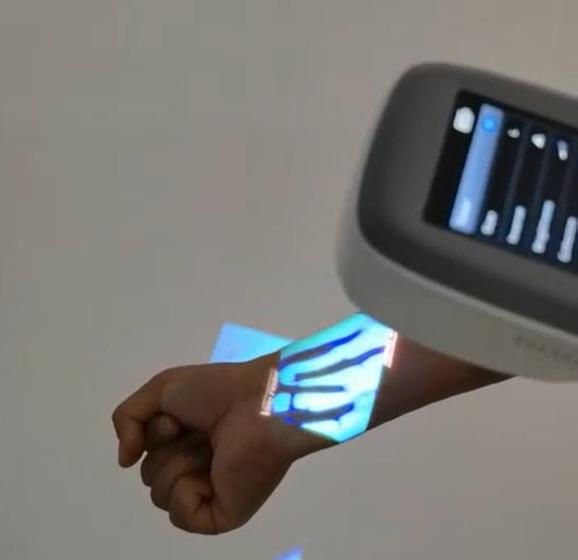 Медицинский венозный сканер QV – обзор и цена Medical Lab Images